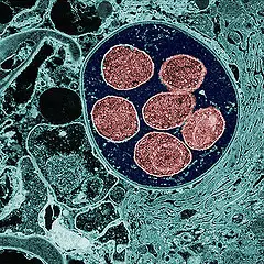 Pneumocystis by AJC1, on Flickr