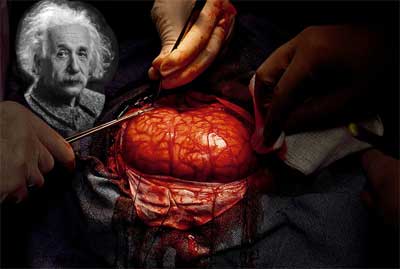 The “Genius” Brain of Albert Einstein is Quite Unusual